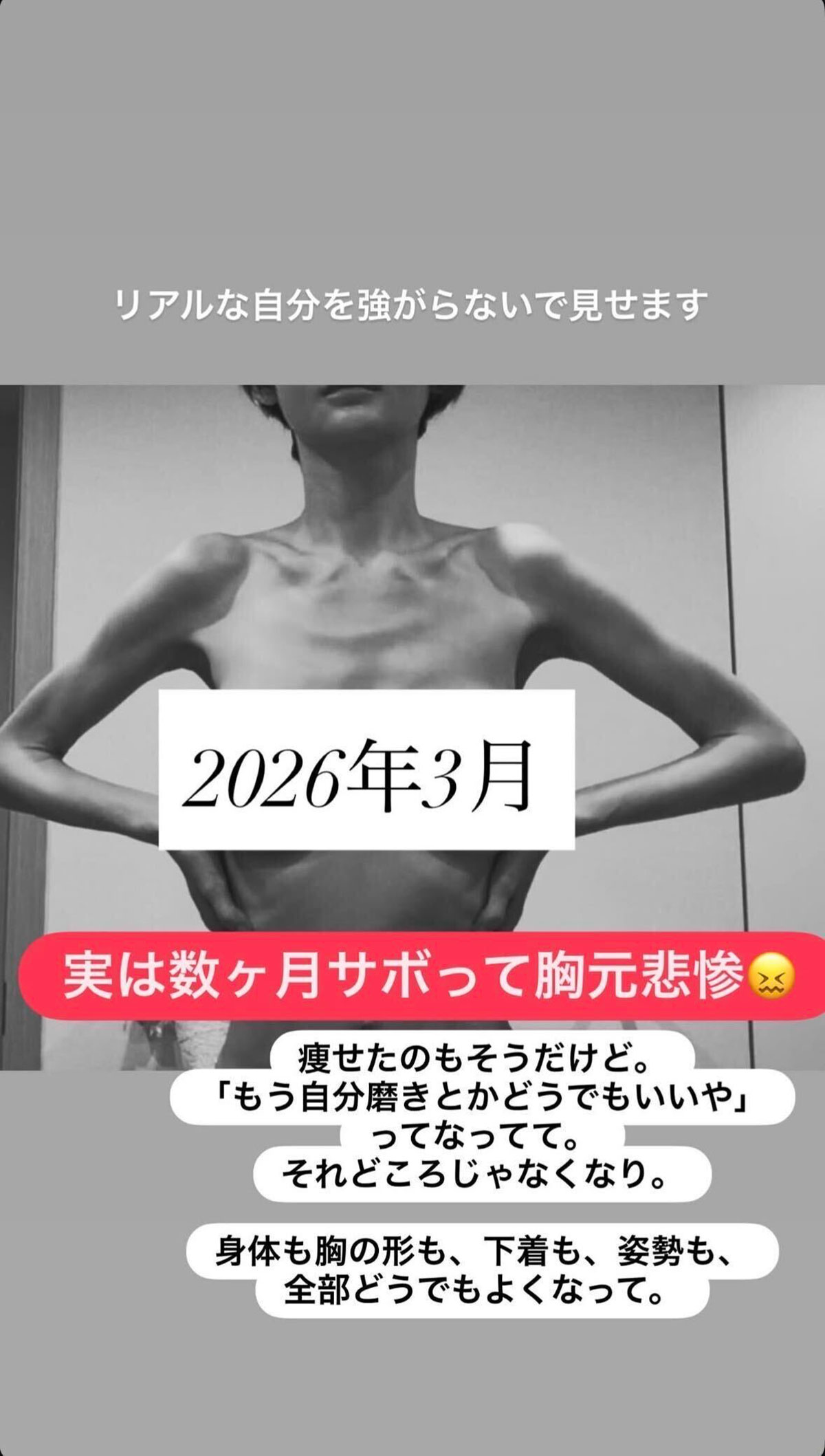 宮崎麗果のInstagramストーリーより。豊胸していることや、激痩せした様子を告白した