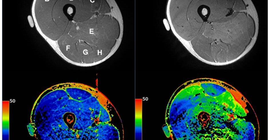 トレーニング効果をもたらす最少量の運動は？　週に何秒、何回必要か　早大などが2024年に調査：ちょっと昔のInnovative Tech - ITmedia NEWS